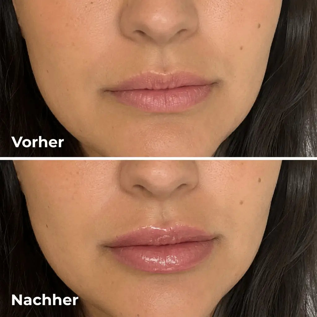 JuicyLips Korean Lip Plumper